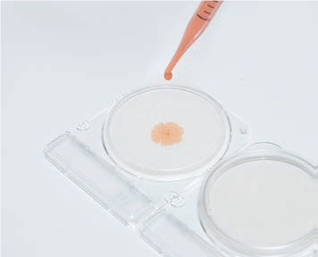 Nhỏ dịch chiết mẫu vào đĩa Compact Dry Listeria