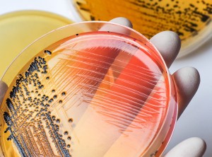 Môi trường tăng sinh Salmonella