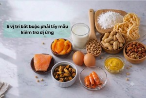 5 vị trí bắt buộc phải lấy mẫu kiểm tra dị ứng trong nhà máy thực phẩm