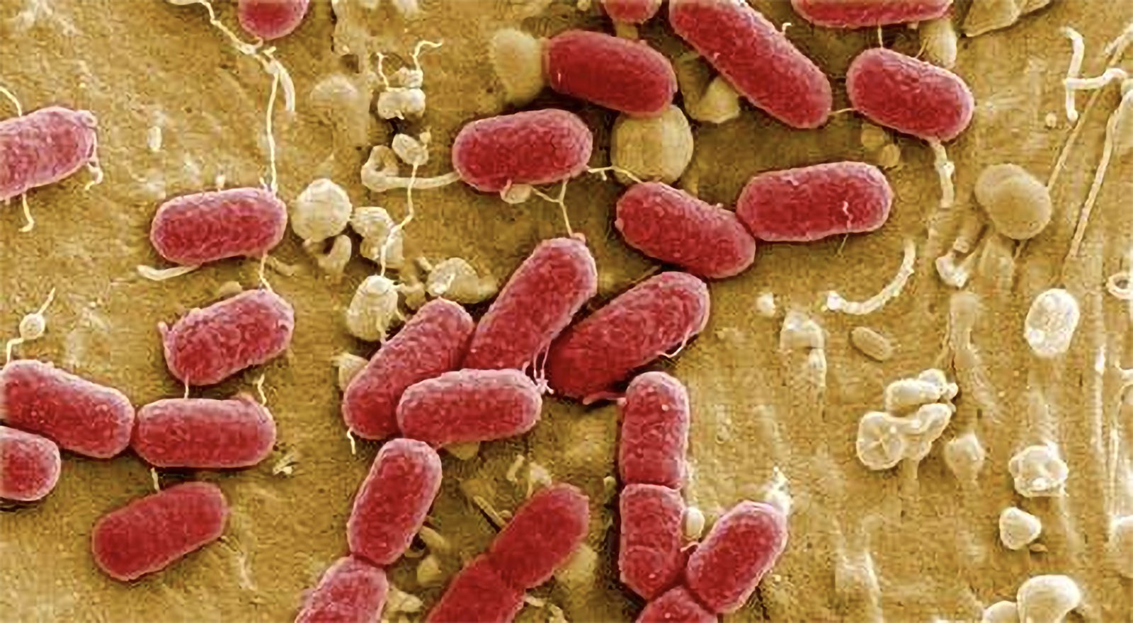 Vi khuẩn Coliform